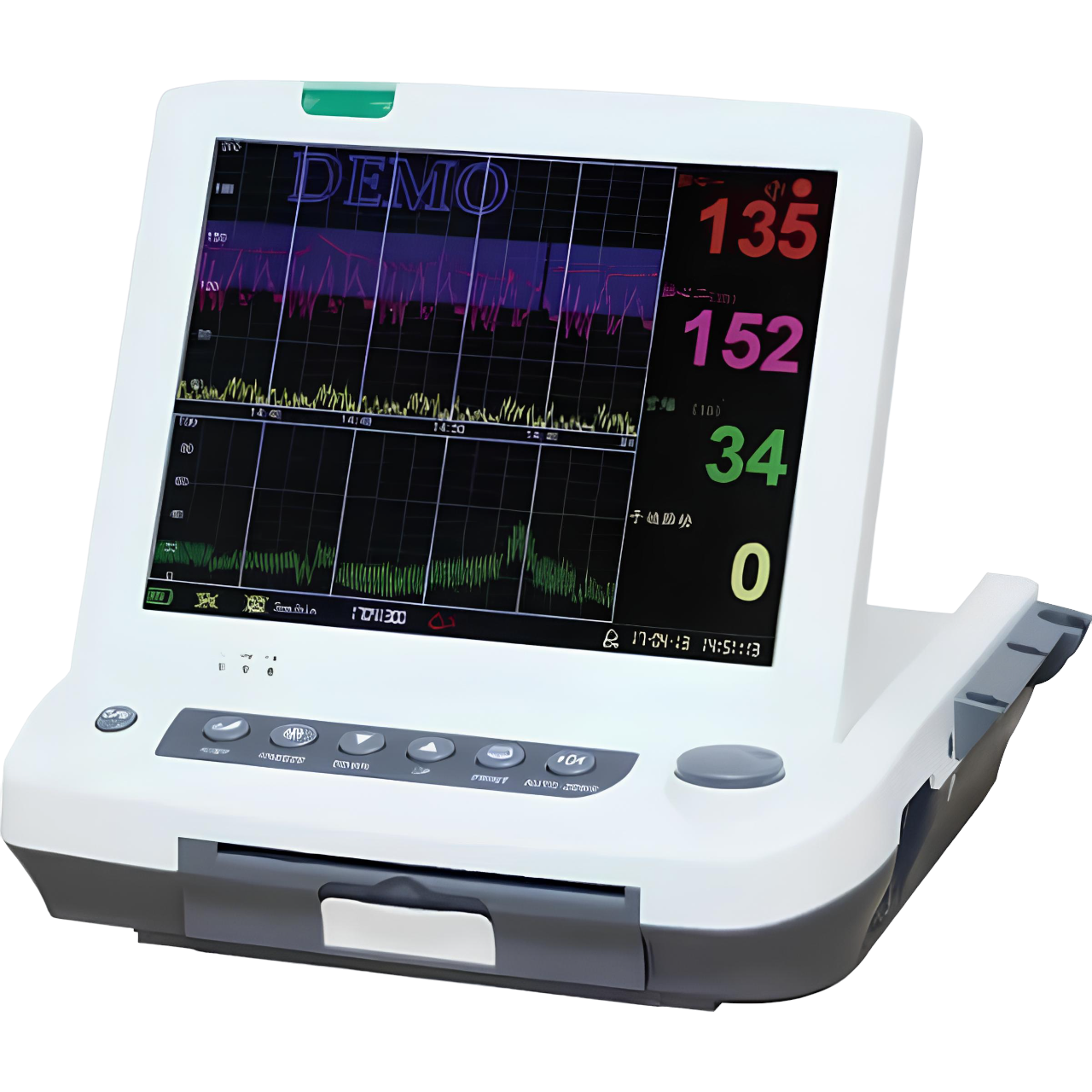 Cardiotógrafo MF 9200 Plus